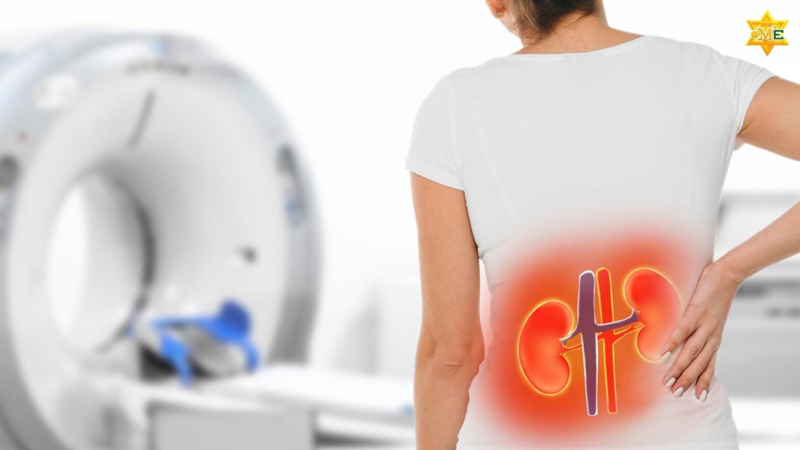 Suy thận mạn là tình trạng chức năng thận suy giảm kéo dài, dẫn đến mất dần khả năng lọc máu và đào thải độc tố