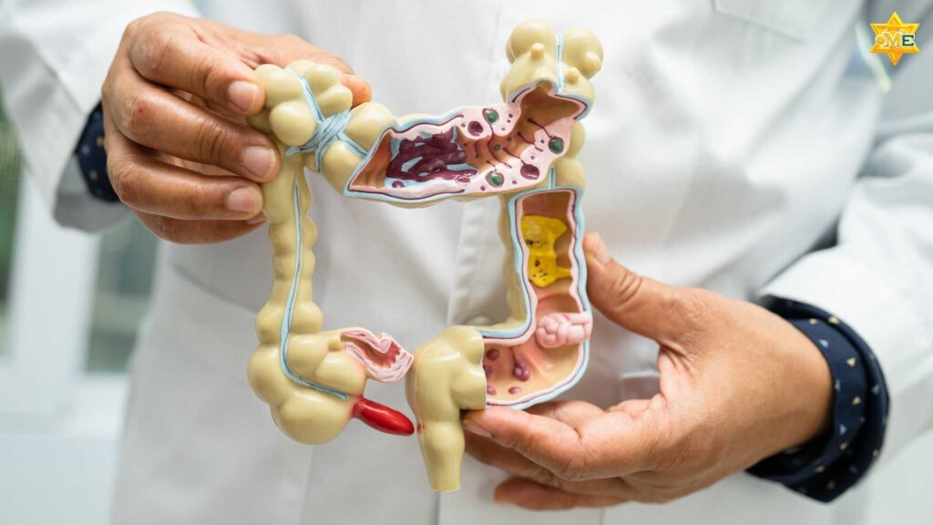 Minh họa vị trí và cấu tạo ung thư thực quản trong hệ tiêu hóa người