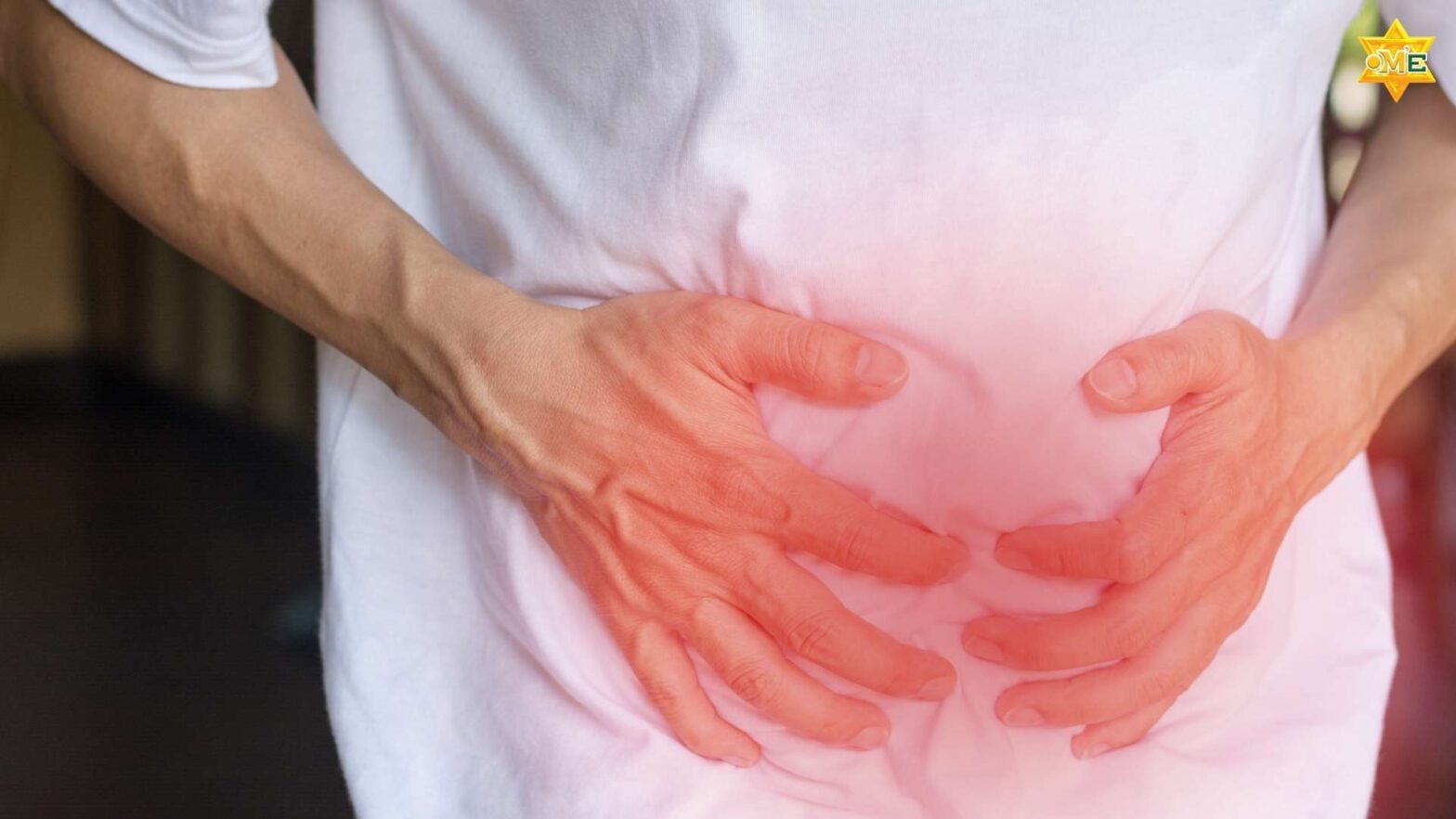 Hình ảnh đại tràng bị viêm với biểu hiện sưng đỏ niêm mạc ruột