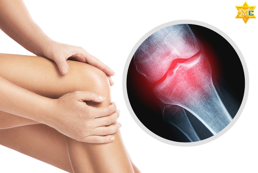 Phòng ngừa và phục hồi thoái hóa khớp như thế nào để đạt hiệu quả lâu dài?