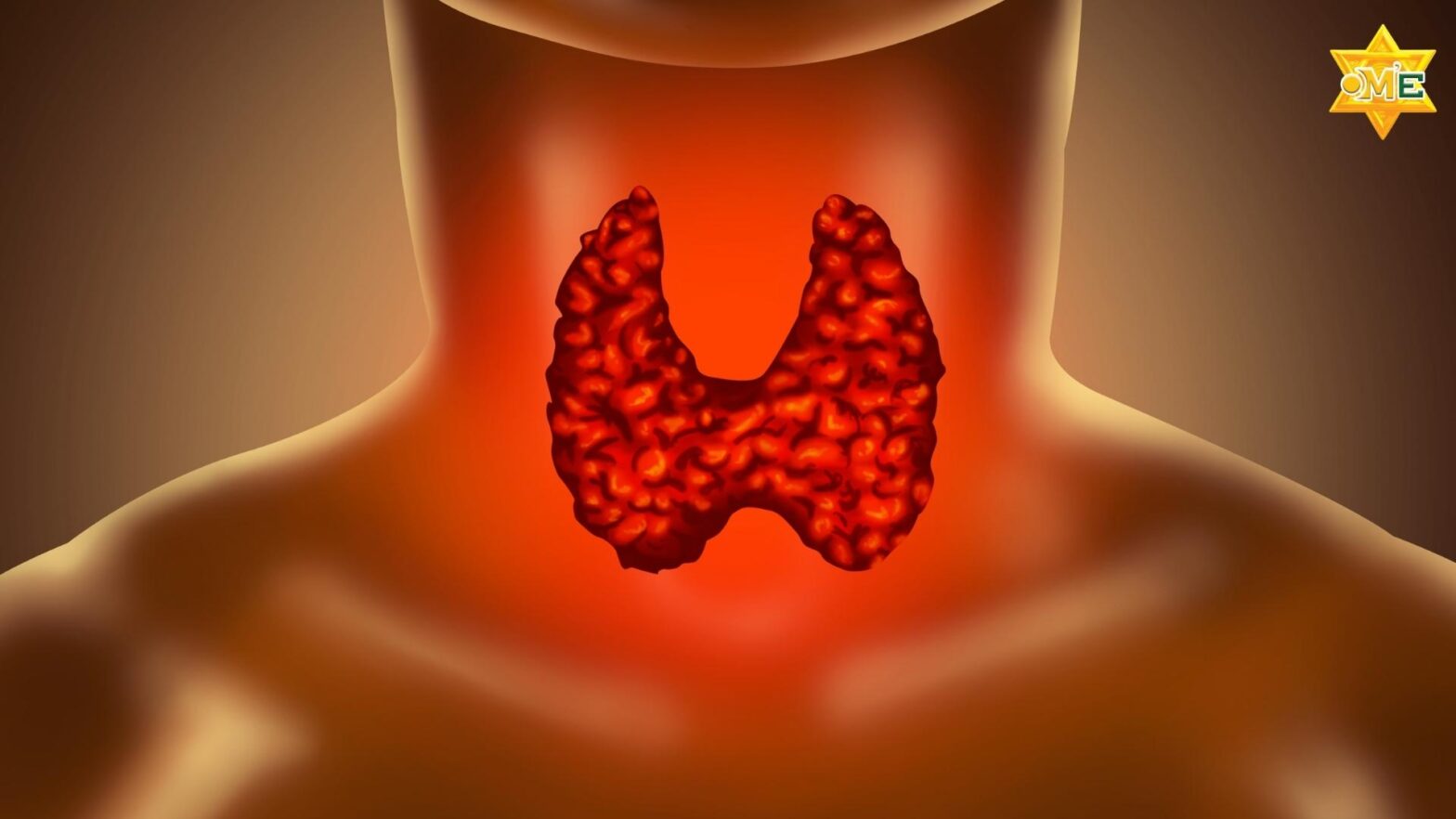 Bệnh suy giáp là gì - vị trí tuyến giáp trên cơ thể người