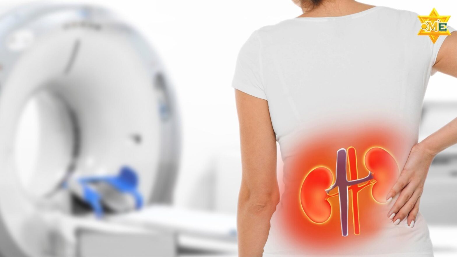 Biến chứng suy thận do hội chứng thận hư