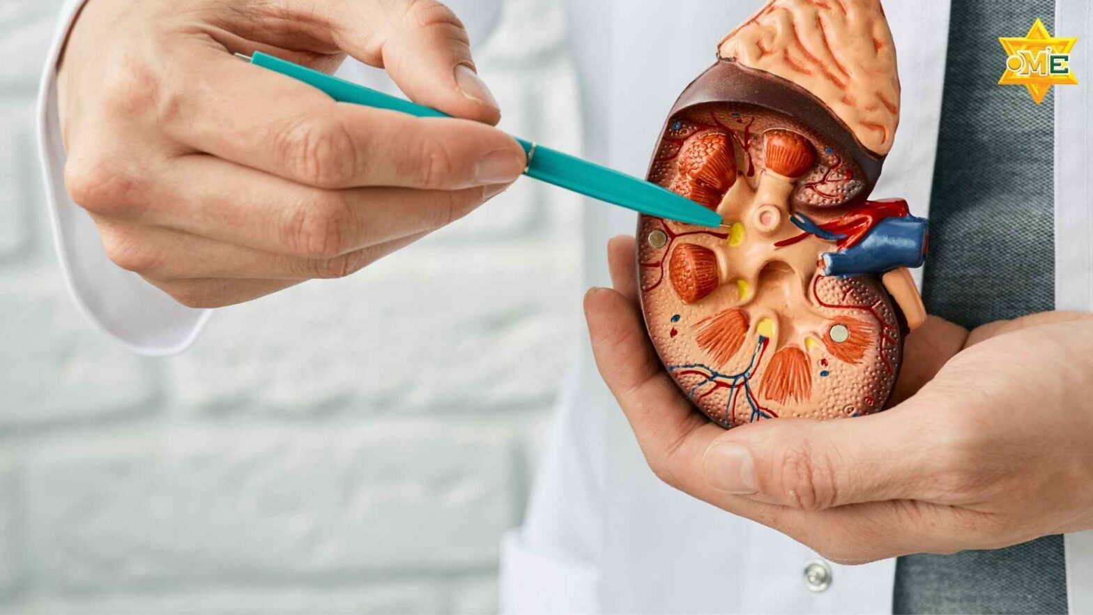 Bác sĩ tư vấn về bệnh suy thận mạn