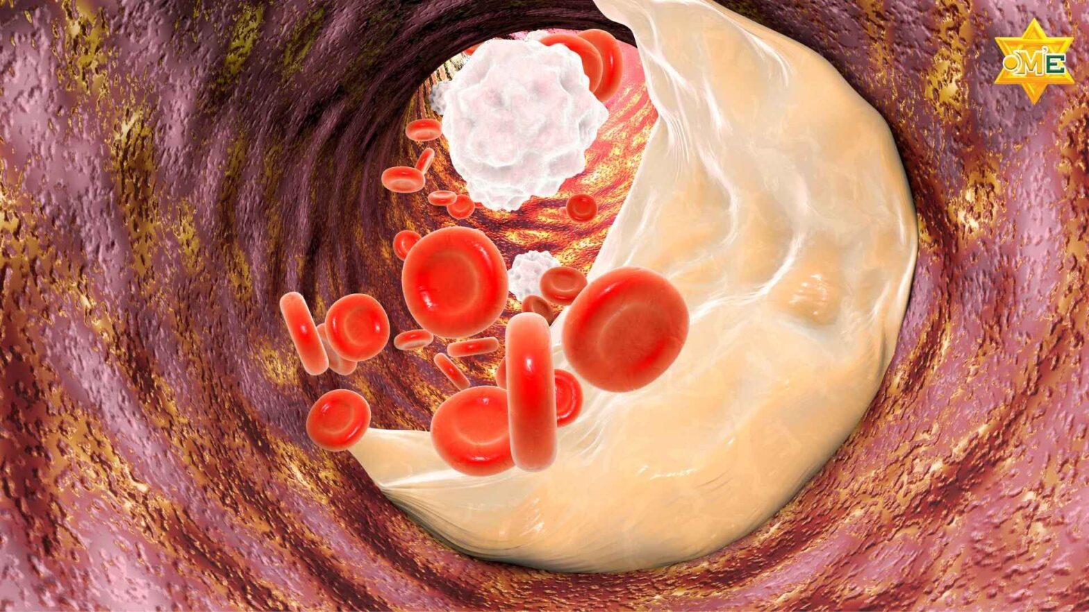 Minh họa não bộ và chế độ ăn uống liên quan đến đột quỵ nên ăn gì