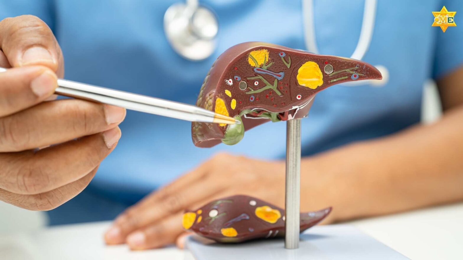 Hình ảnh mô tả quá trình tiến triển từ gan bình thường đến xơ gan mạn tính