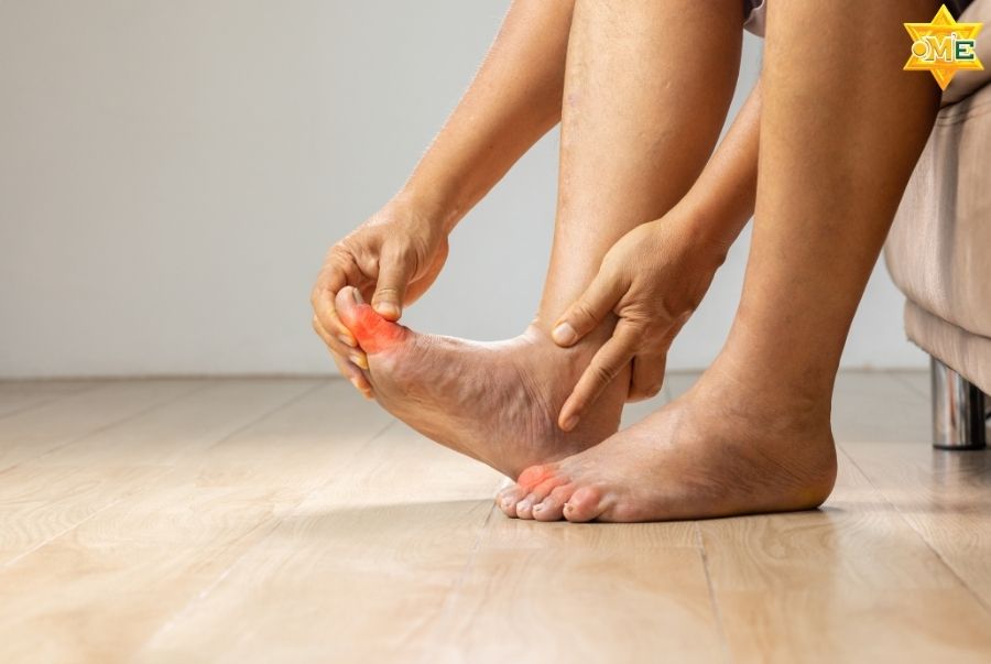 Lưu ý khi bấm huyệt cho người mắc bệnh Gút