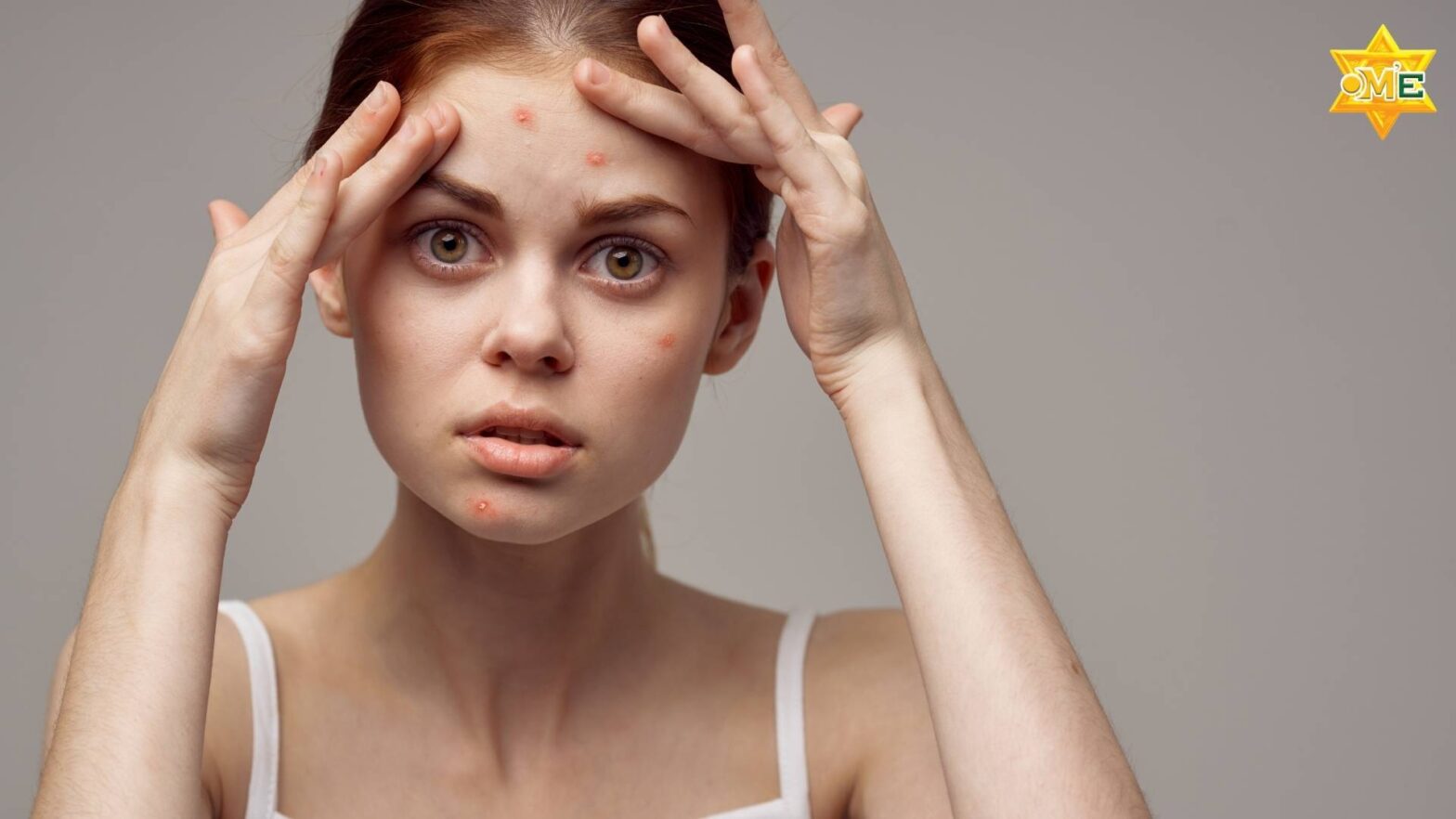 dậy thì sớm ở bé gái