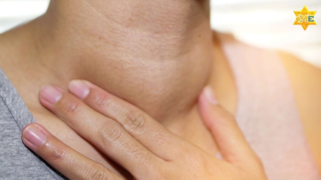 Cường giáp kiêng gì để không nặng hơn