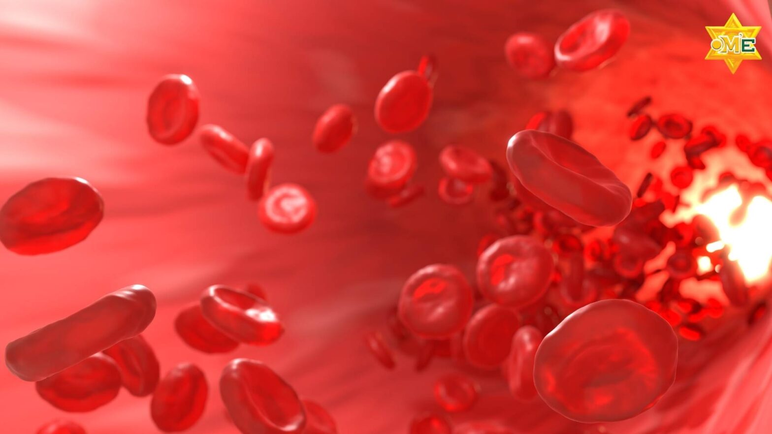 Hình ảnh minh họa não bộ khi bị đột quỵ não