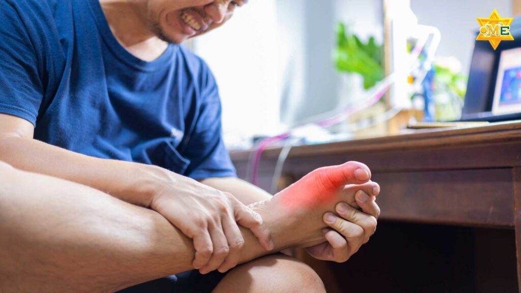 vai trò của dinh dưỡng trong kiểm soát bệnh Gout