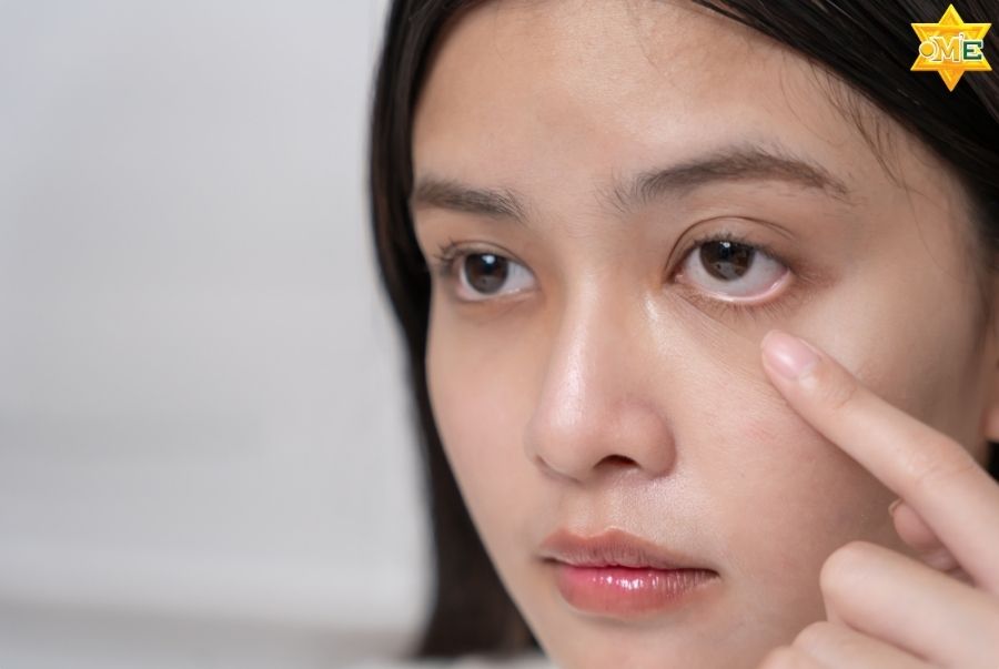 Bấm huyệt chữa mắt mờ ở đâu uy tín?